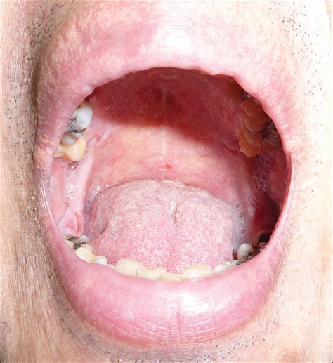 If it is to far back, you will probably cough, that is the gag reflex working. . Peni in mouth